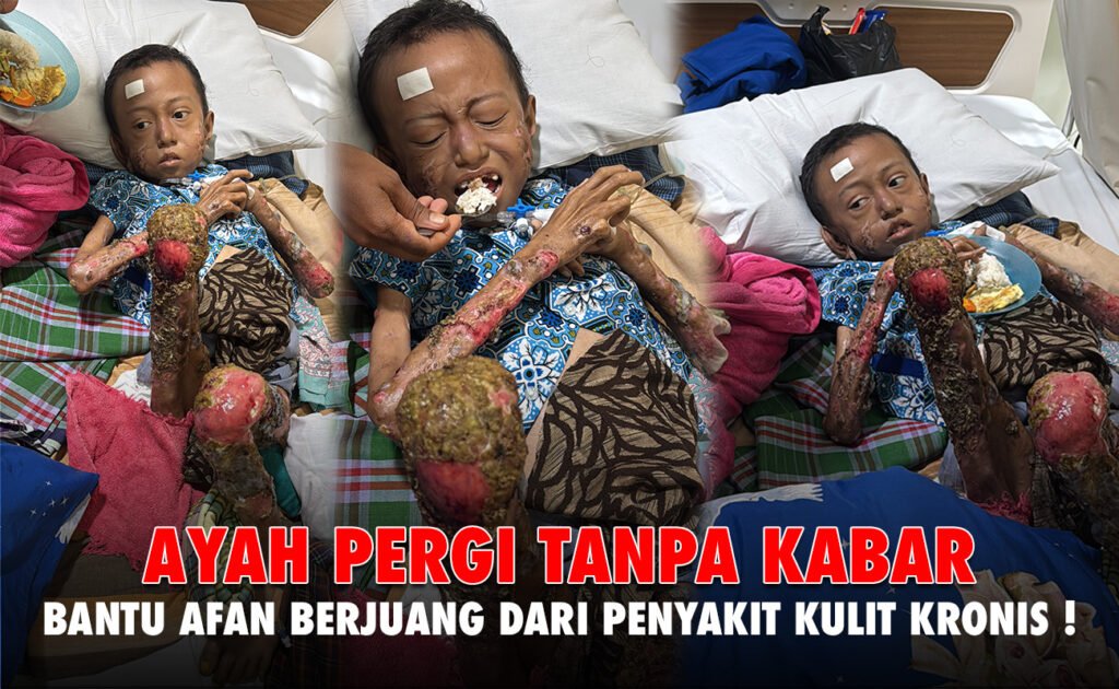 Selamatkan Arfan & Para Pejuang Kesembuhan Di Rumah Singgah